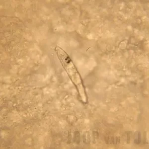 Koi parasieten bestrijden: kieuwworm